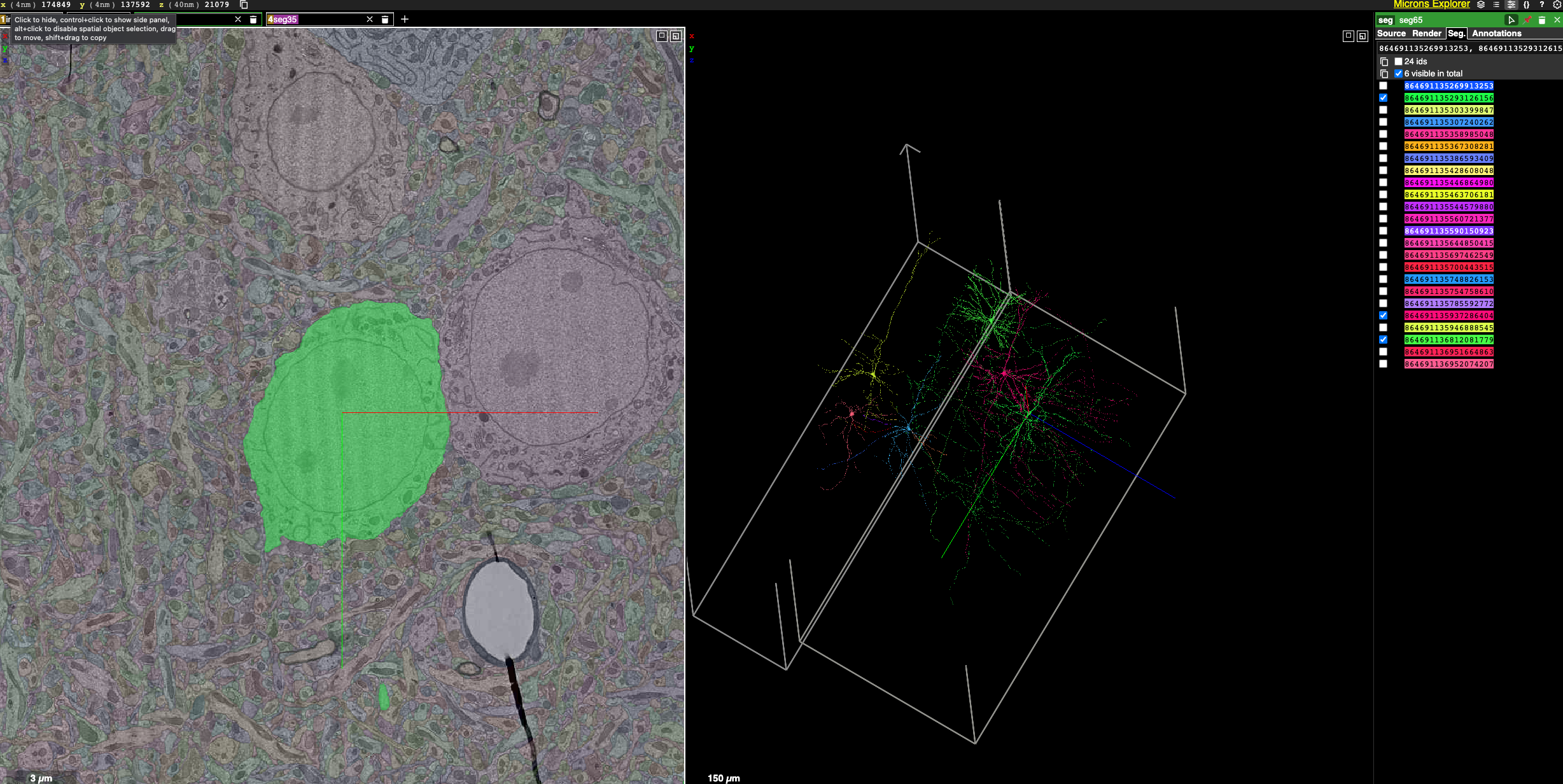 A Roadmap Towards Precision Neuroimaging