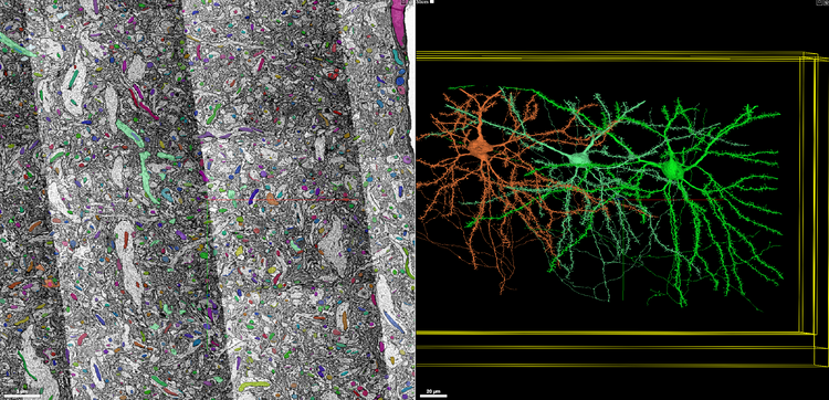 A Roadmap Towards Precision Neuroimaging