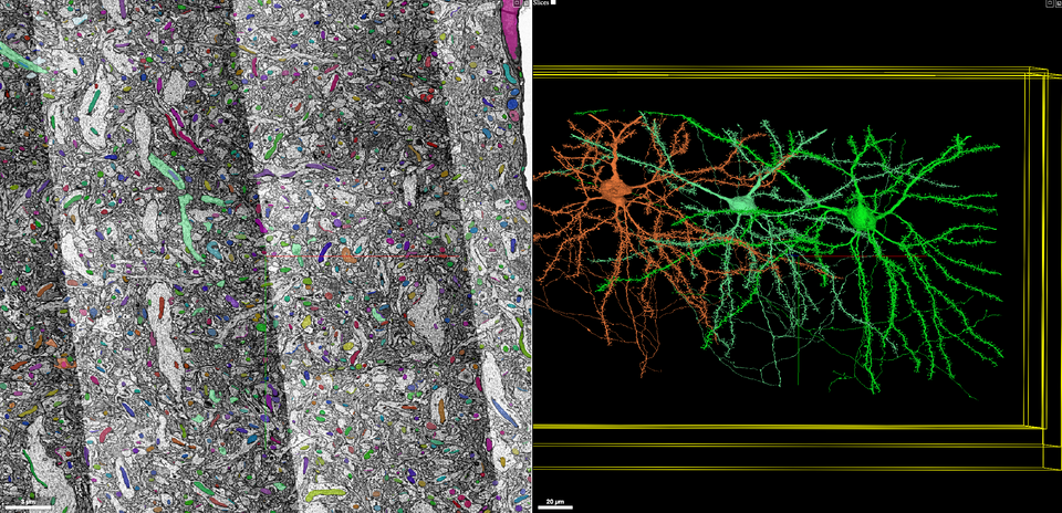 A Roadmap Towards Precision Neuroimaging
